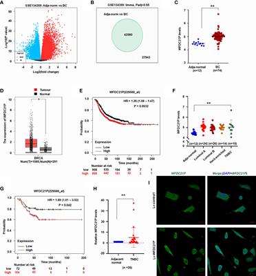 WFDC21P promotes triple-negative breast cancer proliferation and migration through WFDC21P/miR-628/SMAD3 axis